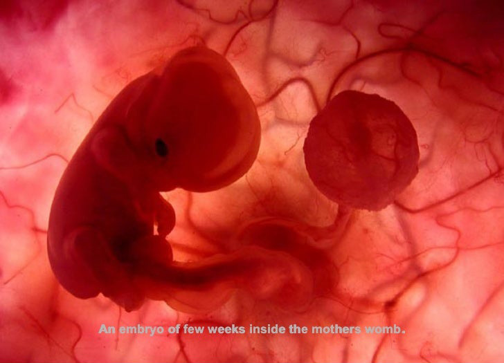 embyro in womb